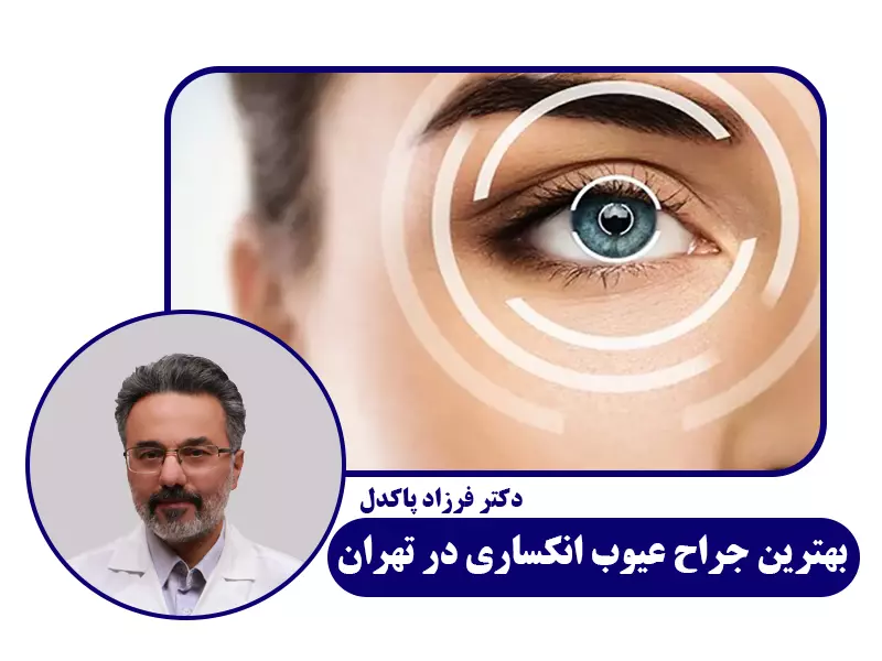 بهترین جراح عیوب انکساری چشم در تهران -1