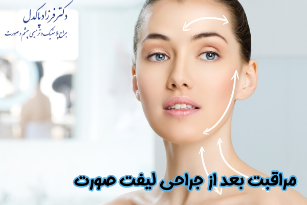 مراقبت بعد از لیفت صورت