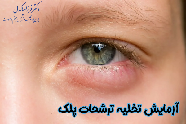 آزمایش تخلیه ترشحات پلک