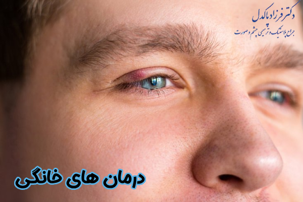 درمان‌ های خانگی