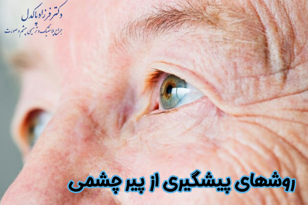 روشهای پیشگیری از پیر چشمی