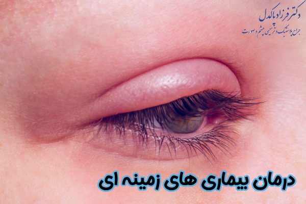 درمان بیماری‌ های زمینه‌ ای